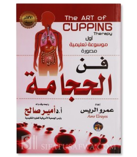 The Art of Cupping Therapy (Hijamah) - with photos - Dr Amr Elrayes  فن الحجامة - د. عمرو الريس